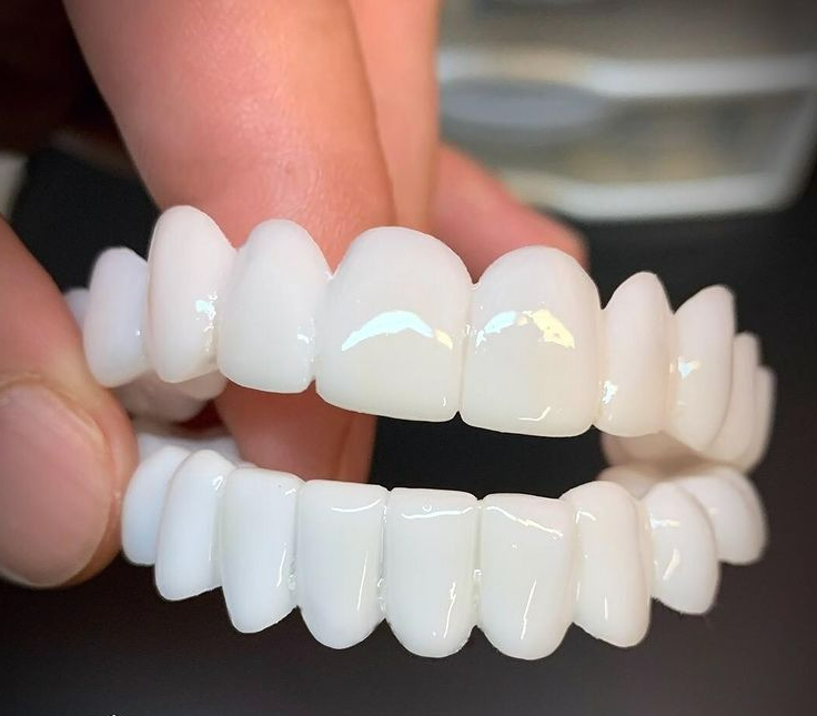 Cosmetic Tooth Cover Removable Snap On Veneer Style for Photos and Events